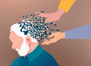 alzheimer