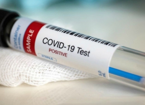 Actualité test Covid-19